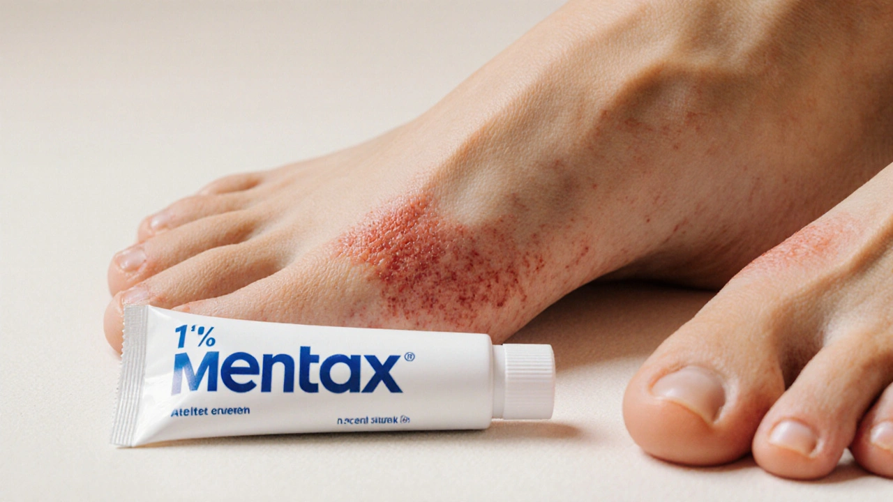 Mentax (Butenafine) vs Other Antifungal Treatments: Detailed Comparison
