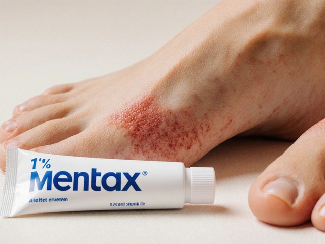 Mentax (Butenafine) vs Other Antifungal Treatments: Detailed Comparison